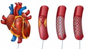 καρδιολόγος αθήνα,